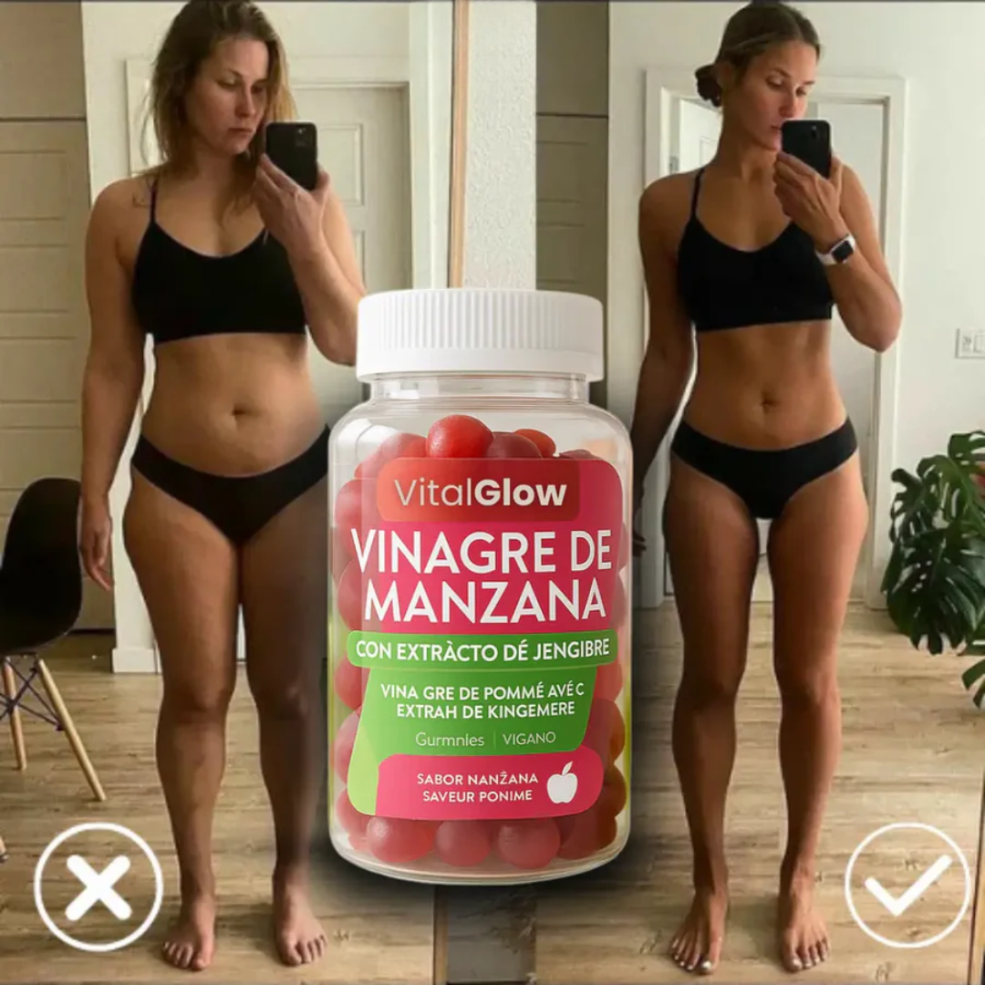 ⚡ Adiós a la hinchazón, hola a la energía! — SUP Gummies que transforman tu día 🌿