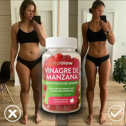 ⚡ Adiós a la hinchazón, hola a la energía! — SUP Gummies que transforman tu día 🌿